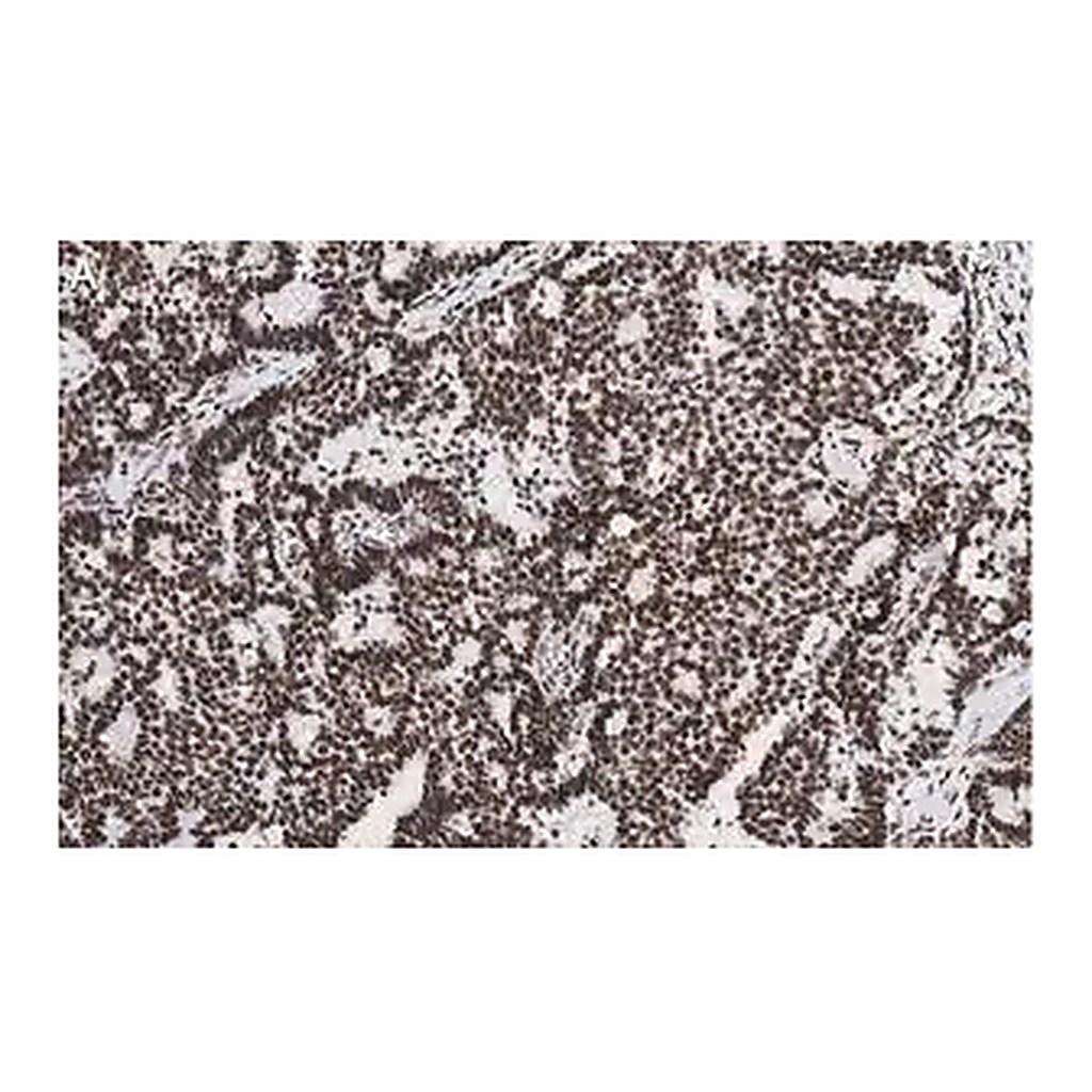 Merck Anti-p-ATM (Ser1981) Antibody, clone 1E19, ZooMAb Rabbit Monoclonal
