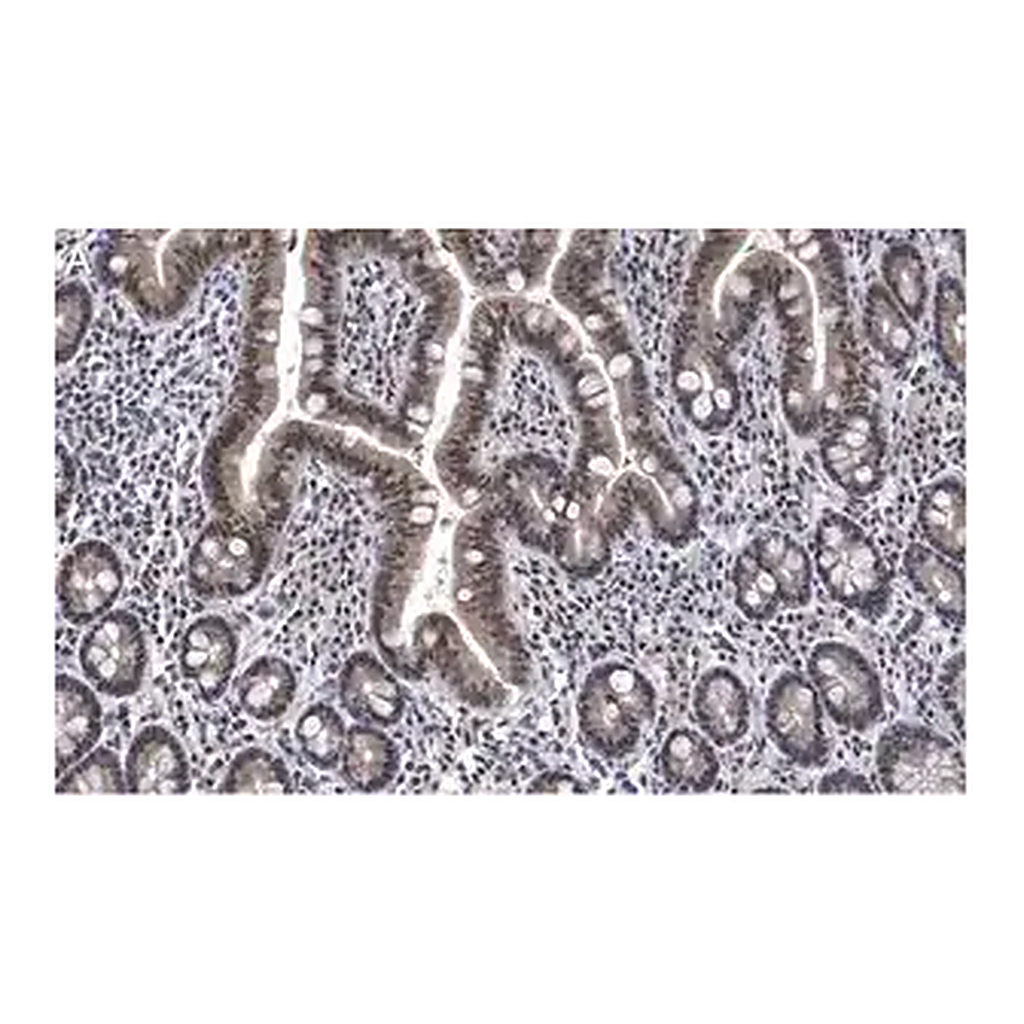 Merck Anti-ATM Antibody, clone 4N19, ZooMAb Rabbit Monoclonal
