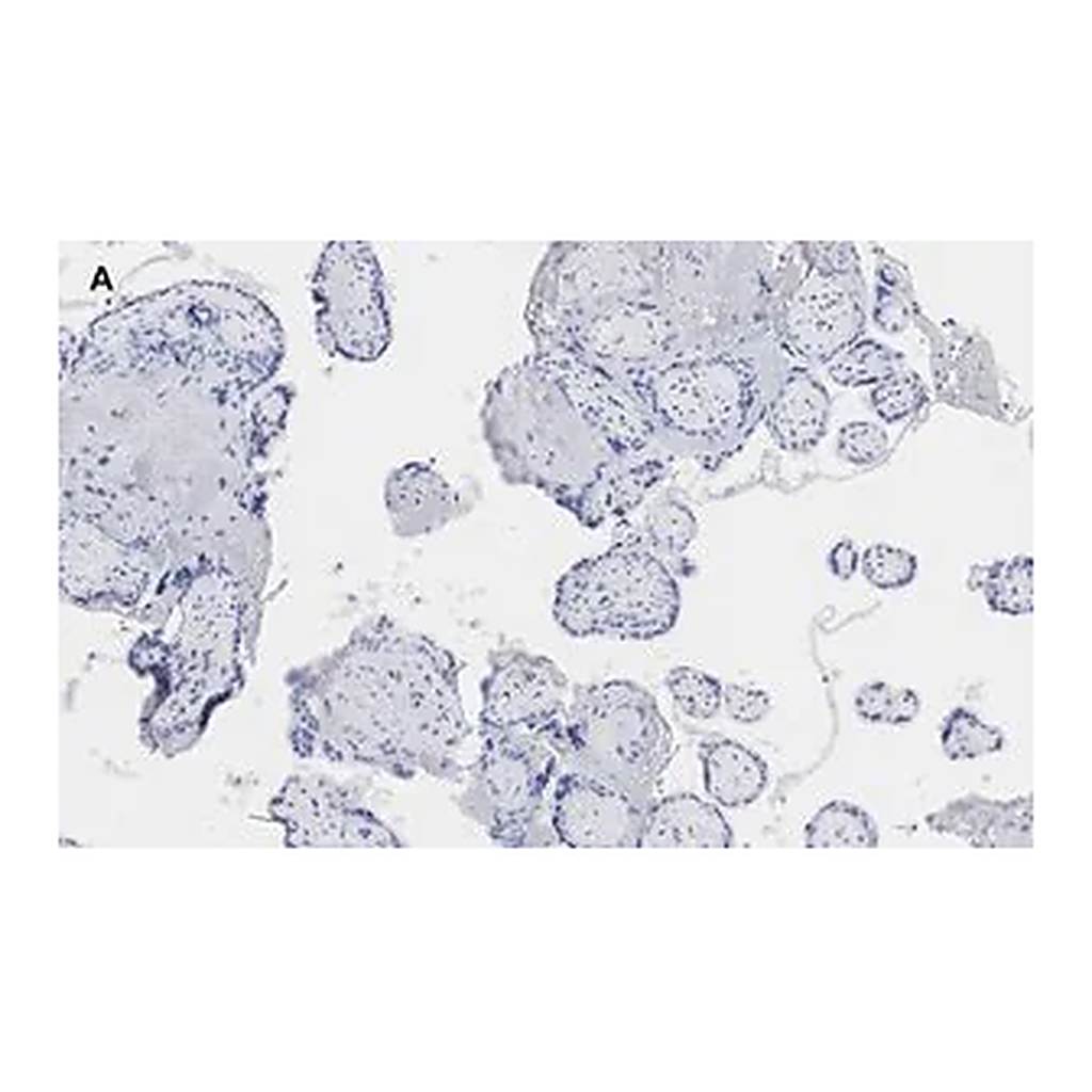 Merck Anti-BCRP (ABCG2) Antibody, clone 10K5 , ZooMAb Rabbit Monoclonal