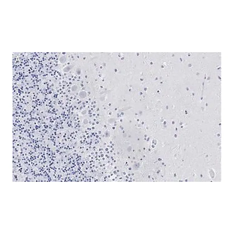 Merck Anti-Aldolase C Antibody, clone 3B18, ZooMAb Rabbit Monoclonal