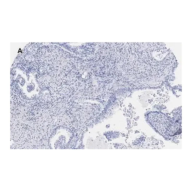 Merck Anti-EpCAM Antibody, clone 1B8 , ZooMAb Rabbit Monoclonal