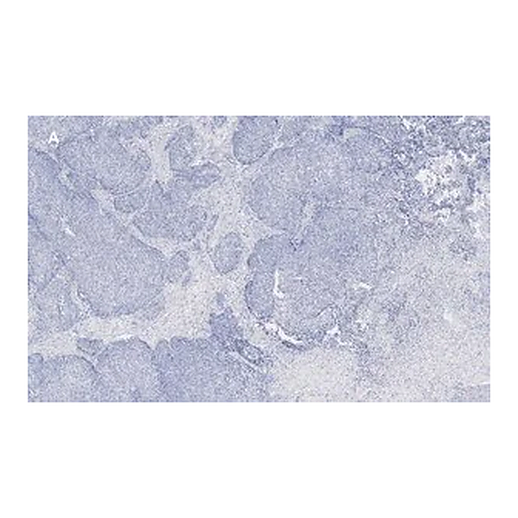 Merck Anti-TAGLN Antibody, clone 1D10 , ZooMAb Rabbit Monoclonal