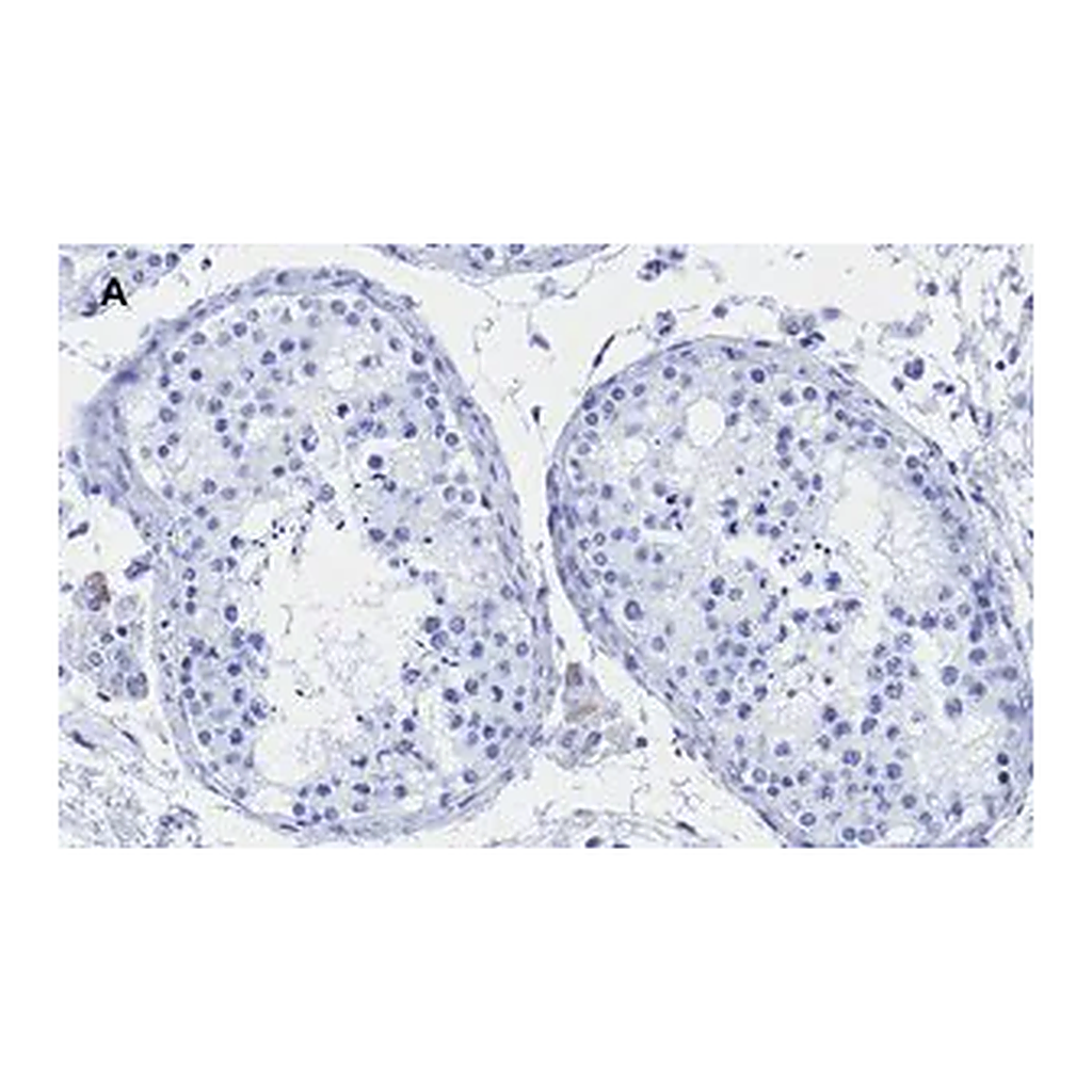 Merck Anti-Androgen Receptor Antibody, clone 3K11 , ZooMAb Rabbit Monoclonal