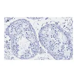 Merck Anti-Androgen Receptor Antibody, clone 3K11 , ZooMAb Rabbit Monoclonal