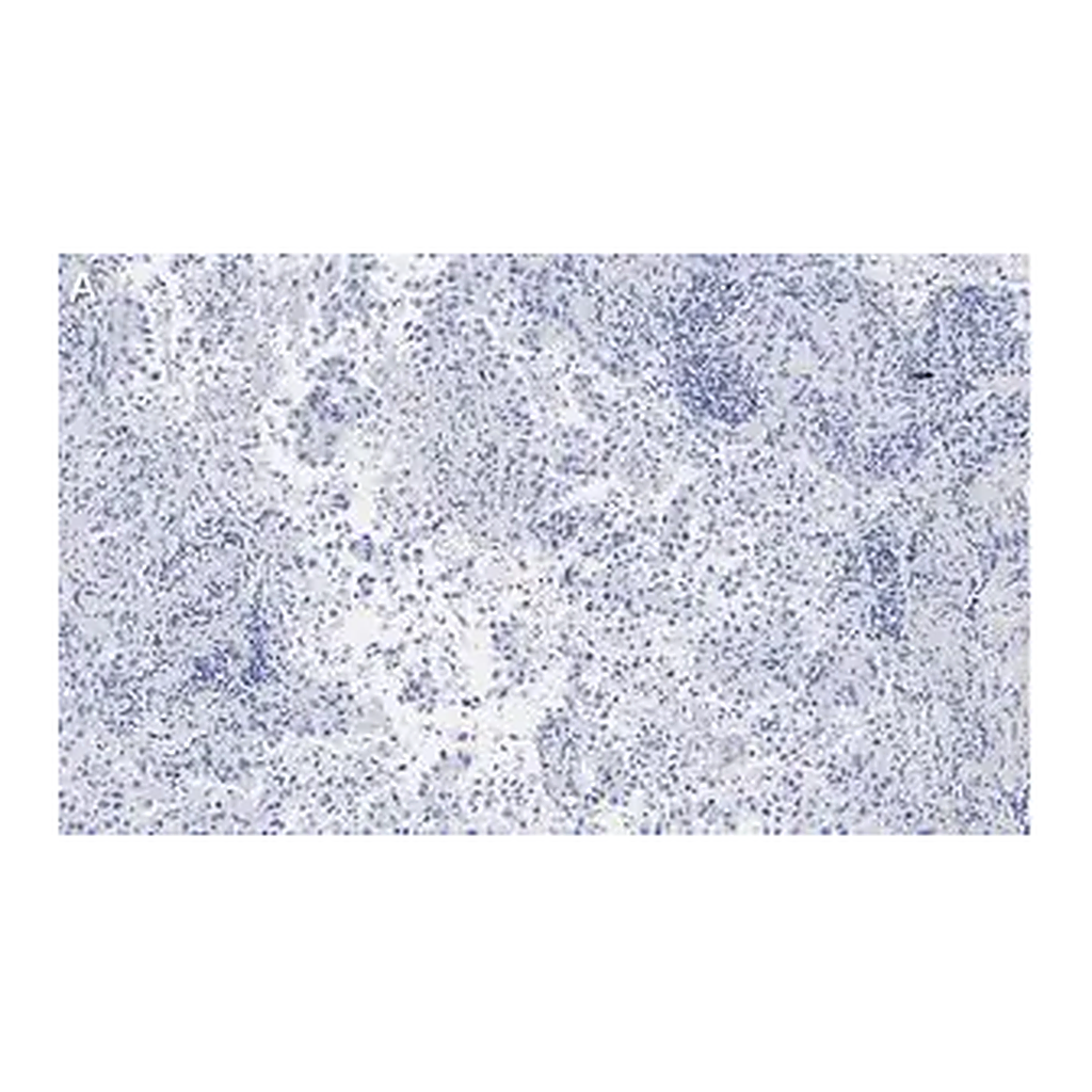 Merck Anti-Integrin αVβ5 Antibody, clone EM09902 , ZooMAb Rabbit Monoclonal