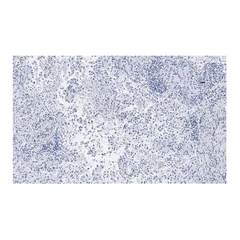 Merck Anti-Integrin αVβ5 Antibody, clone EM09902 , ZooMAb Rabbit Monoclonal