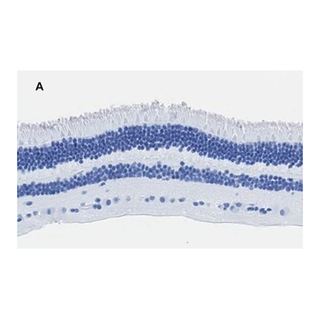 Merck Anti-Recoverin Antibody, clone 1J23, ZooMAb Rabbit Monoclonal