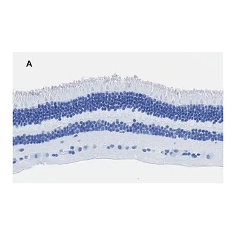 Merck Anti-Recoverin Antibody, clone 1J23, ZooMAb Rabbit Monoclonal