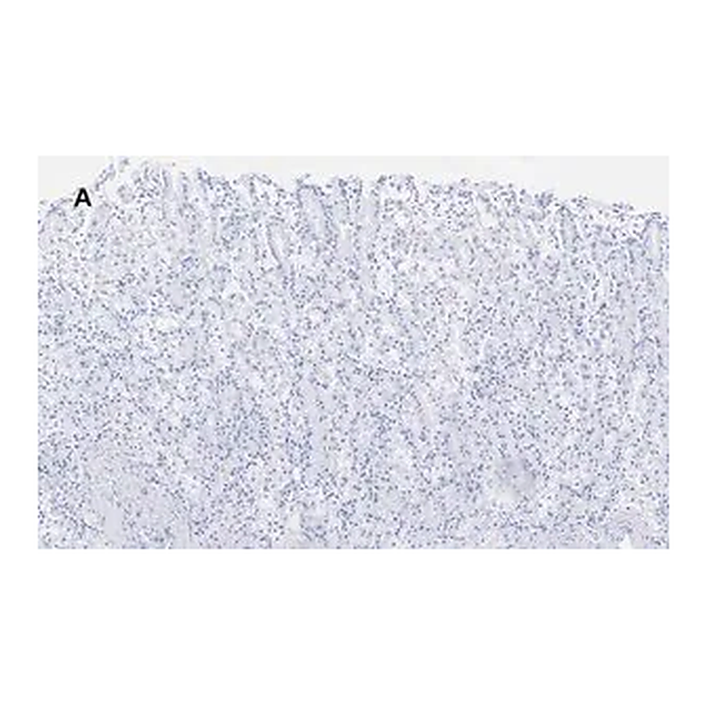 Merck Anti-ALDH1A1 Antibody, clone 4J6, ZooMAb Rabbit Monoclonal