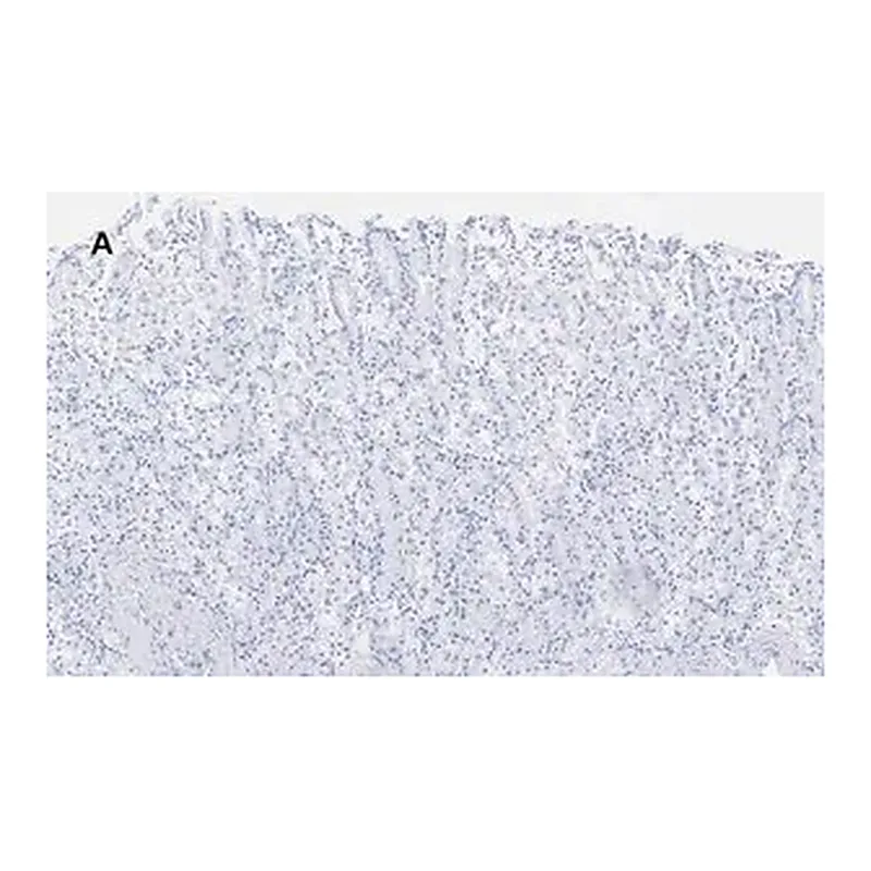 Merck Anti-ALDH1A1 Antibody, clone 4J6, ZooMAb Rabbit Monoclonal