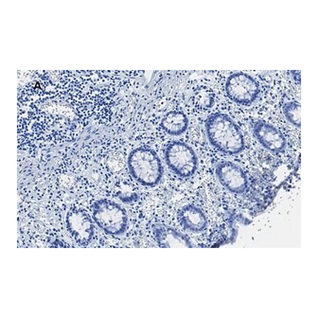 Merck Anti-TATA Binding Protein Antibody, clone 5J13, ZooMAb Rabbit Monoclonal
