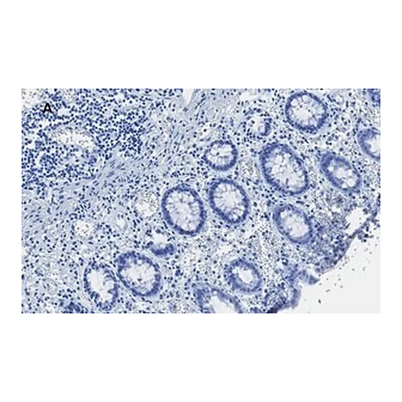 Merck Anti-TATA Binding Protein Antibody, clone 5J13, ZooMAb Rabbit Monoclonal