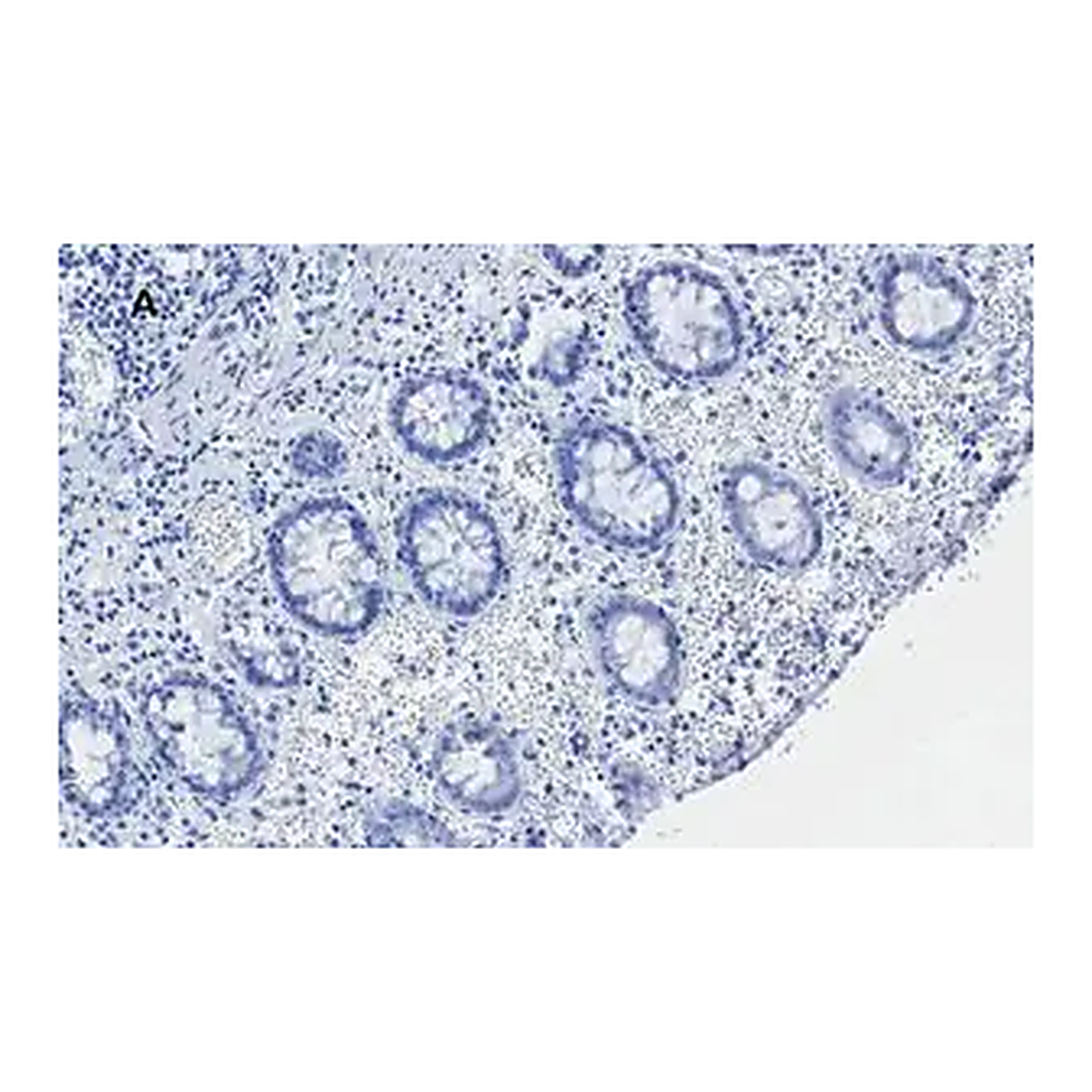 Merck Anti-C-EBP beta Antibody, clone 8G18, ZooMAb Rabbit Monoclonal