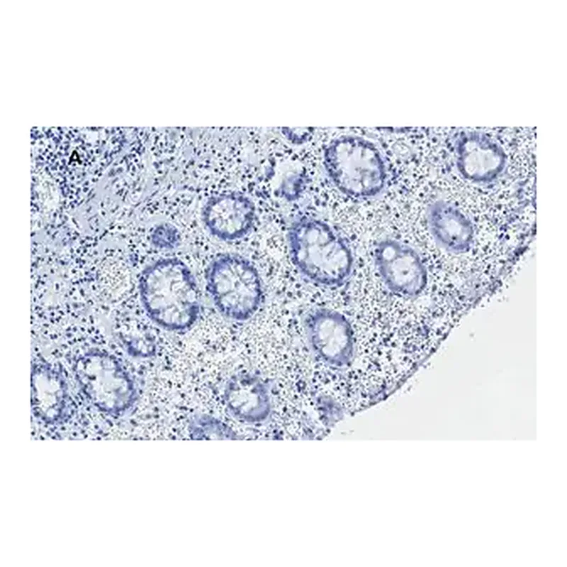 Merck Anti-C-EBP beta Antibody, clone 8G18, ZooMAb Rabbit Monoclonal