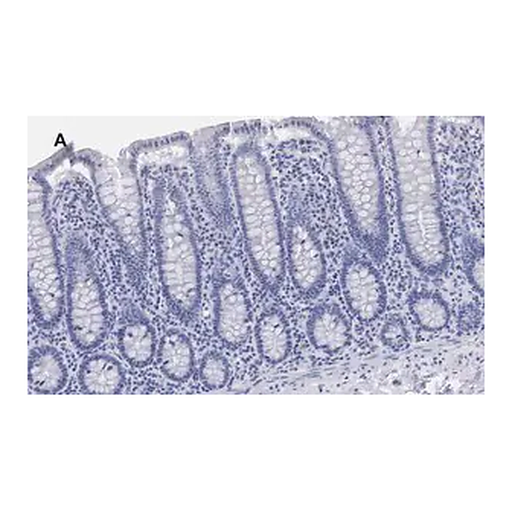 Merck Anti-BRG1 Antibody, clone 1N12, ZooMAb Rabbit Monoclonal