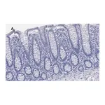 Merck Anti-BRG1 Antibody, clone 1N12, ZooMAb Rabbit Monoclonal