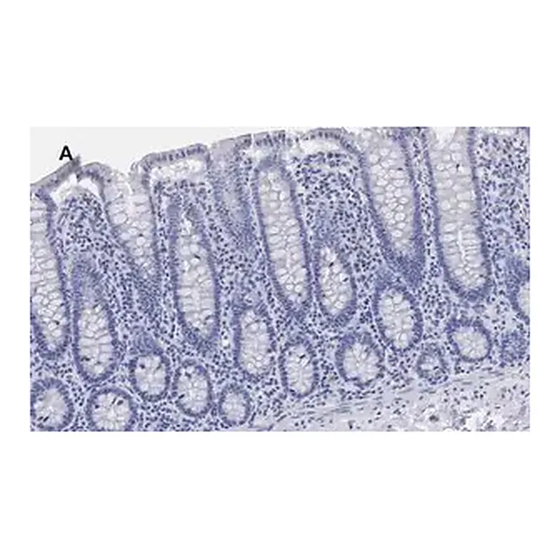 Merck Anti-BRG1 Antibody, clone 1N12, ZooMAb Rabbit Monoclonal