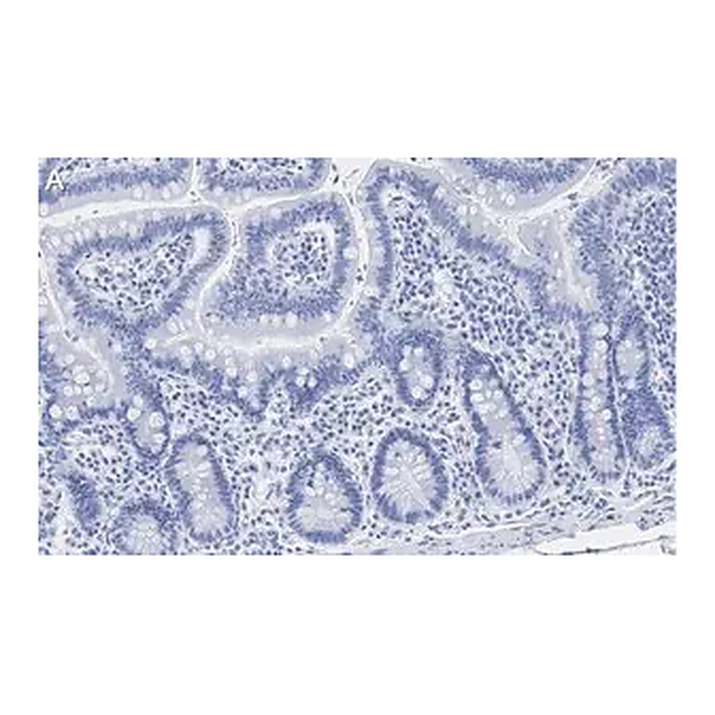 Merck Anti-Caspase-1 (p20) Antibody, clone 2G4 , ZooMAb Rabbit Monoclonal