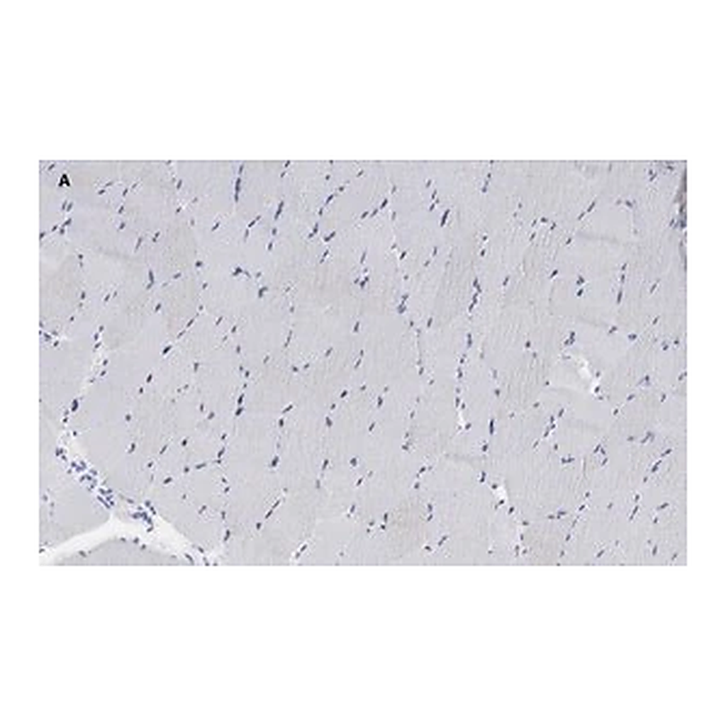 Merck Anti-alpha Actinin 2 Antibody, clone 1E11, ZooMAb Rabbit Monoclonal