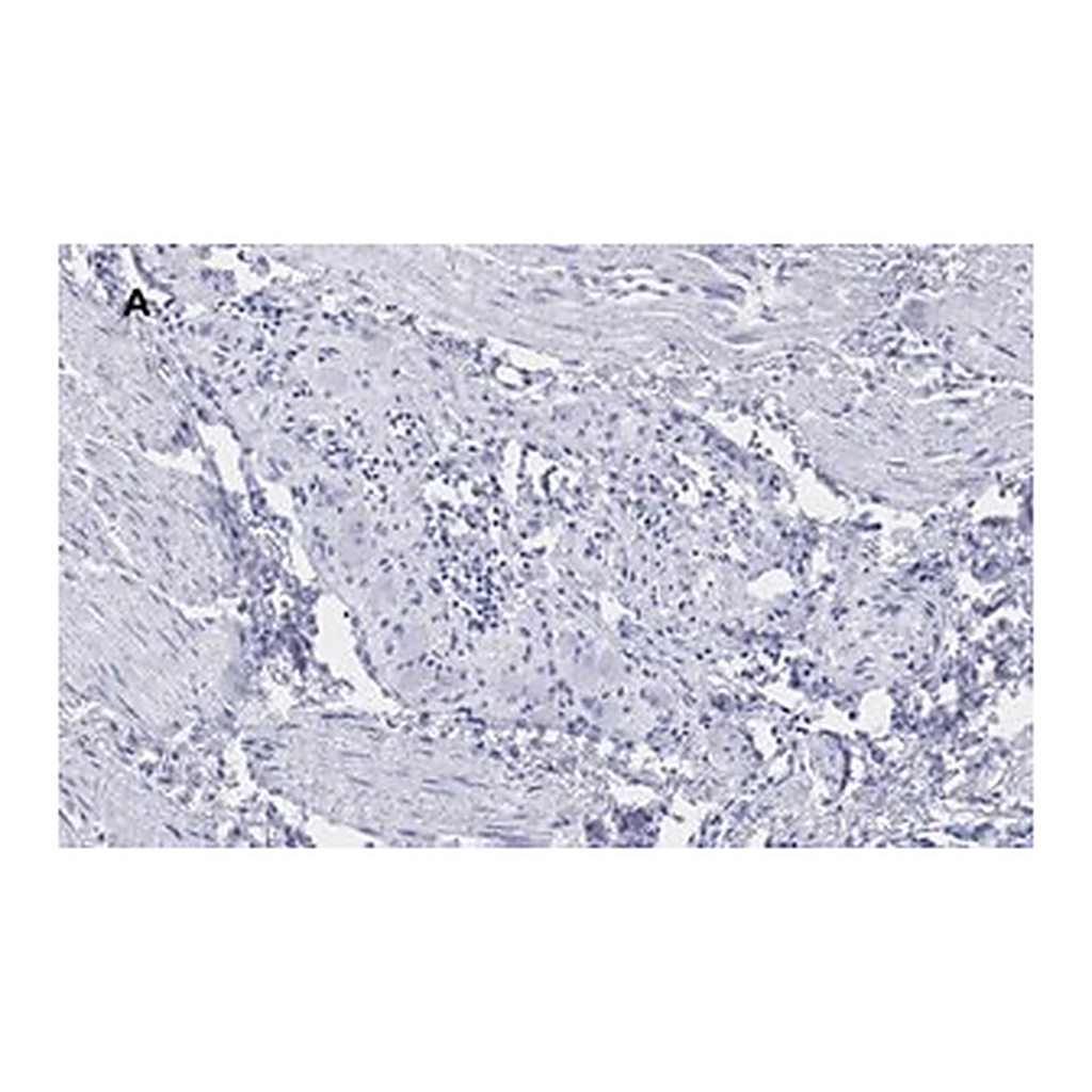 Merck Anti-Peripherin Antibody, clone 1D4, ZooMAb Rabbit Monoclonal