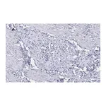Merck Anti-Peripherin Antibody, clone 1D4, ZooMAb Rabbit Monoclonal
