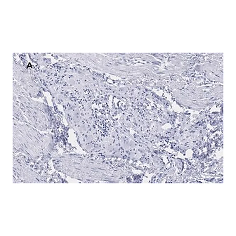 Merck Anti-Peripherin Antibody, clone 1D4, ZooMAb Rabbit Monoclonal