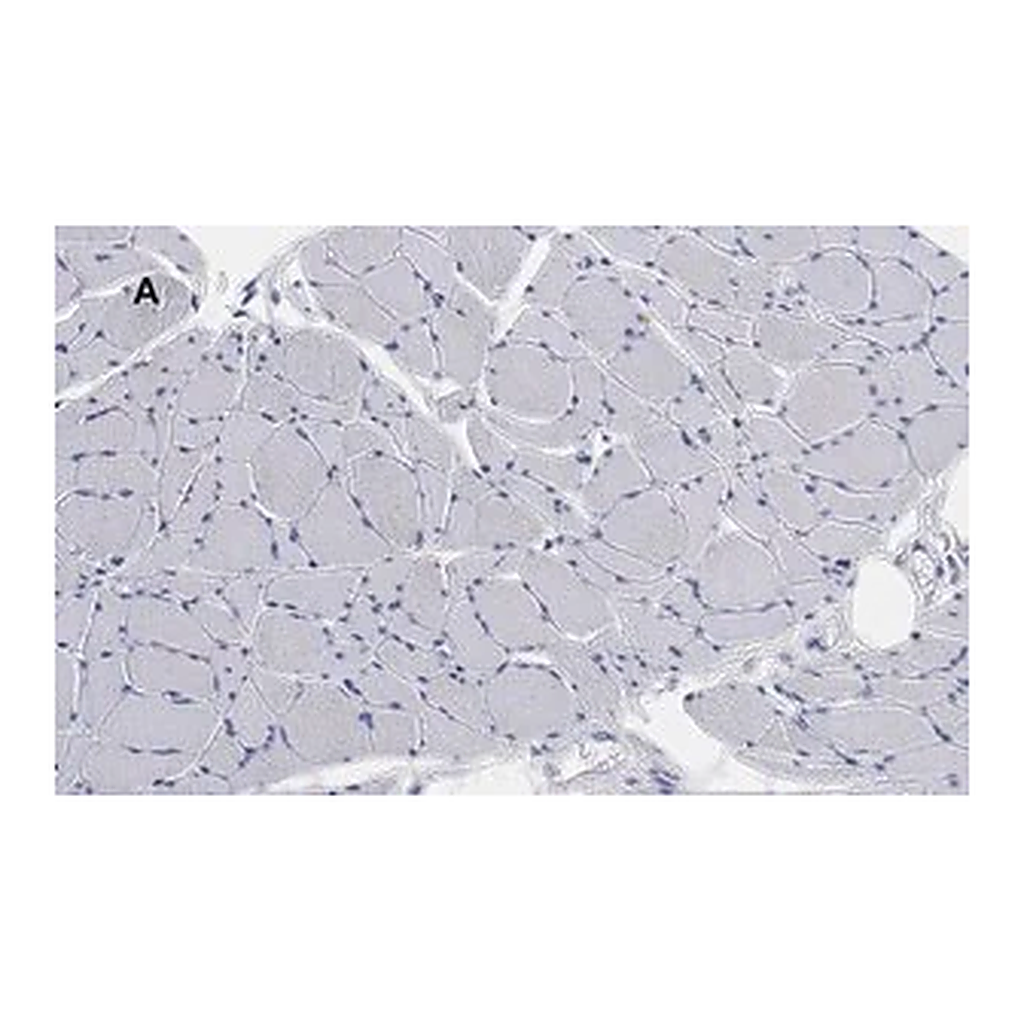 Merck Anti-Desmin Antibody, clone 1H16, ZooMAb Rabbit Monoclonal