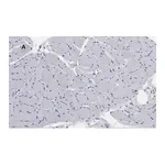 Merck Anti-Desmin Antibody, clone 1H16, ZooMAb Rabbit Monoclonal