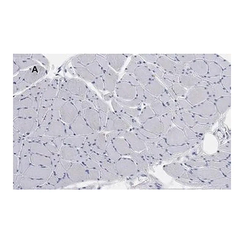 Merck Anti-Desmin Antibody, clone 1H16, ZooMAb Rabbit Monoclonal