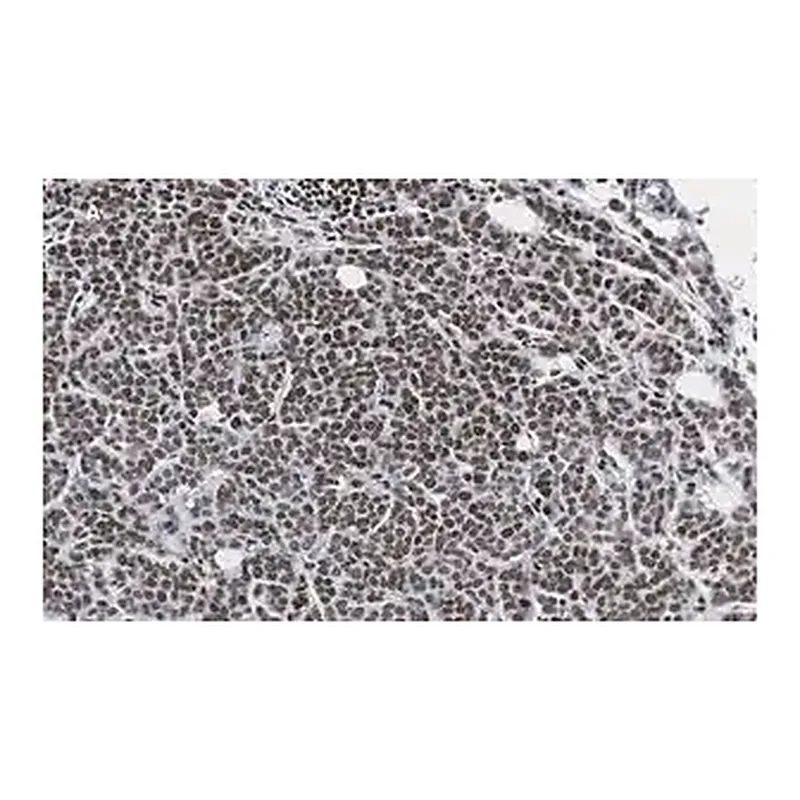 Merck Anti-phospho-IRS1 (Tyr612) Antibody, clone 1N14, ZooMAb Rabbit Monoclonal