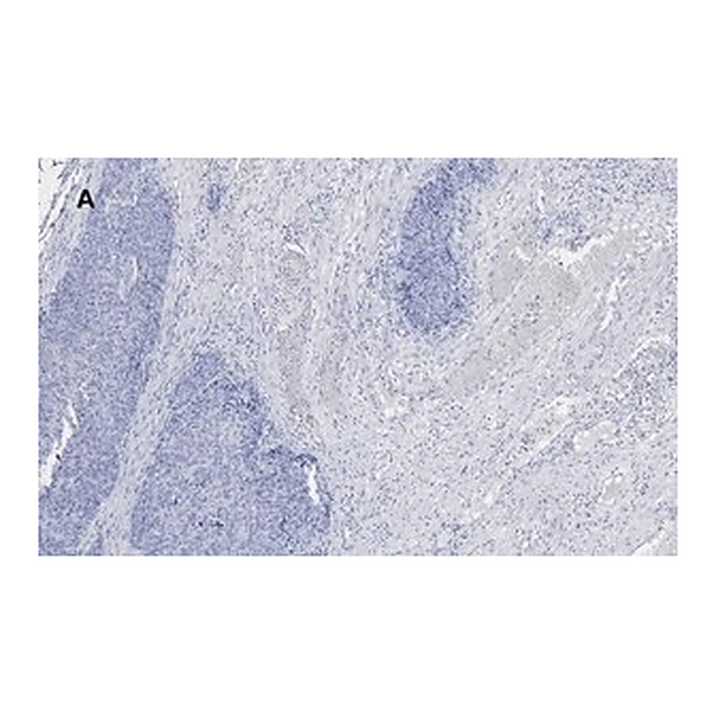 Merck Anti-Calponin 1 Antibody, clone 9D14, ZooMAb Rabbit Monoclonal