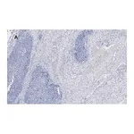 Merck Anti-Calponin 1 Antibody, clone 9D14, ZooMAb Rabbit Monoclonal