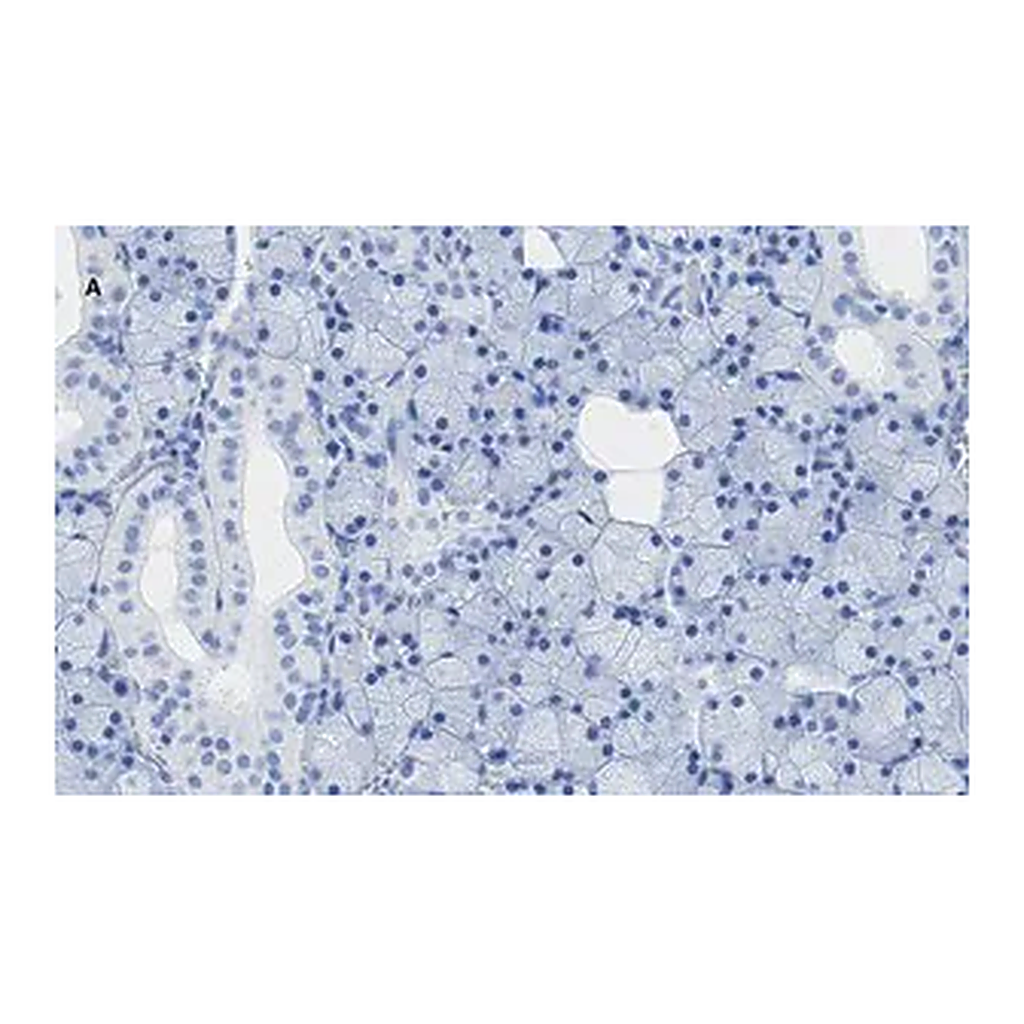 Merck Anti-TMEM16A Antibody, clone 3J18, ZooMAb Rabbit Monoclonal