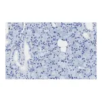 Merck Anti-TMEM16A Antibody, clone 3J18, ZooMAb Rabbit Monoclonal