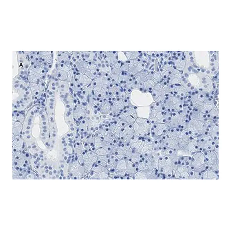 Merck Anti-TMEM16A Antibody, clone 3J18, ZooMAb Rabbit Monoclonal