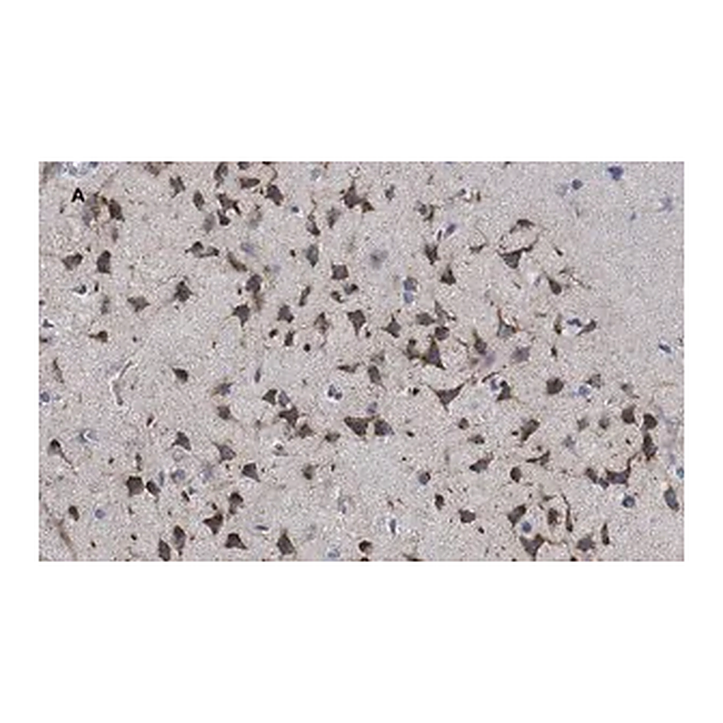 Merck Anti-phospho-GluR1 (Ser831) Antibody, clone N453, ZooMAb Rabbit Monoclonal