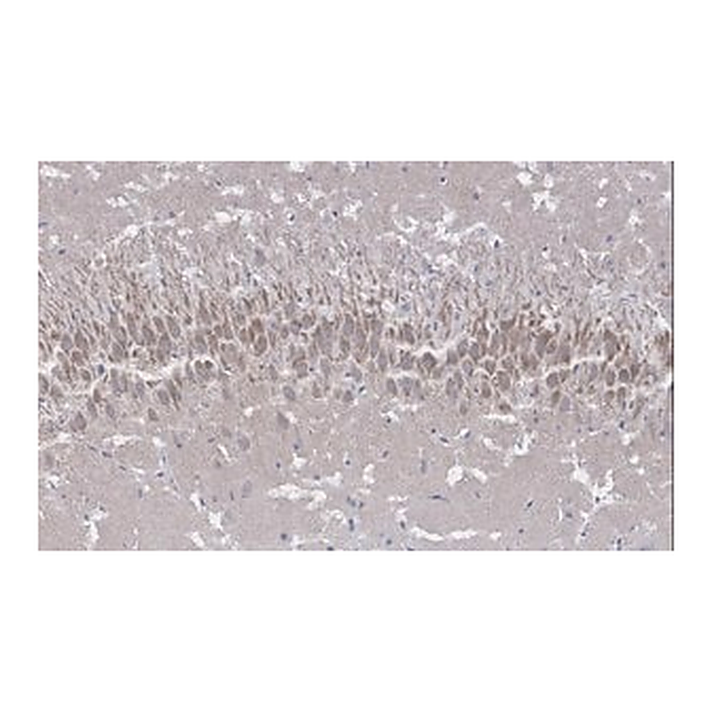 Merck Anti-NMDAR2A Antibody, clone A12W, ZooMAb Rabbit Monoclonal