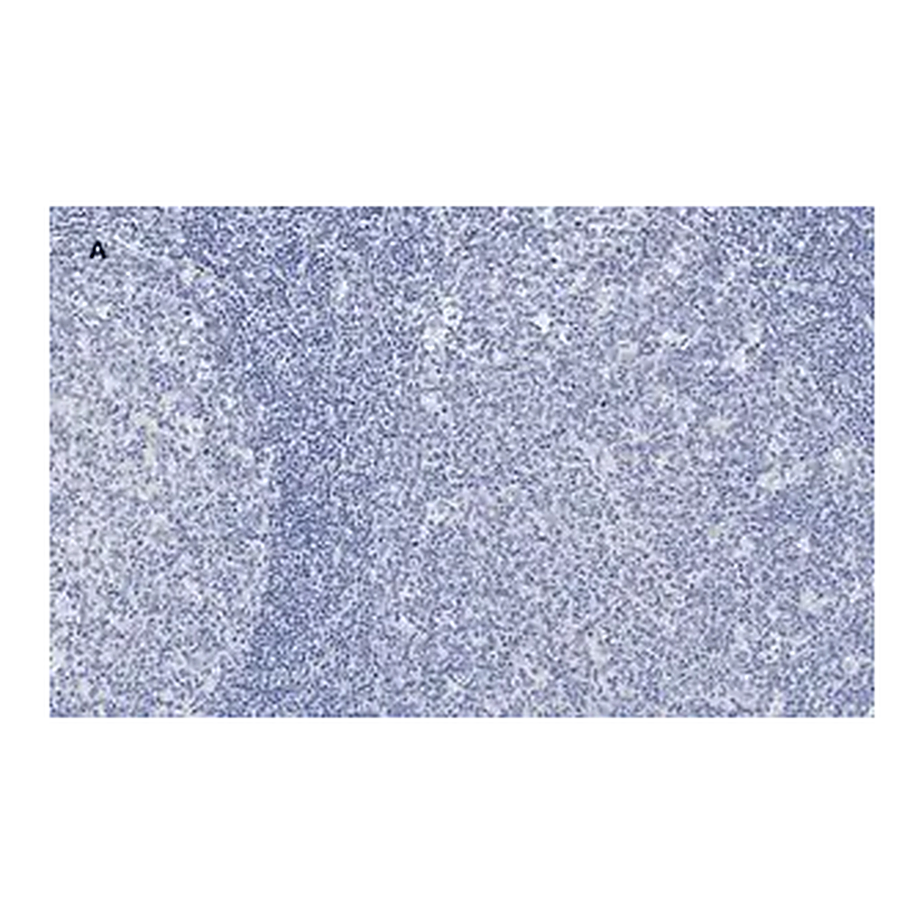 Merck Anti-NF-kB p50/105 Antibody, clone 1N19, ZooMAb Rabbit Monoclonal