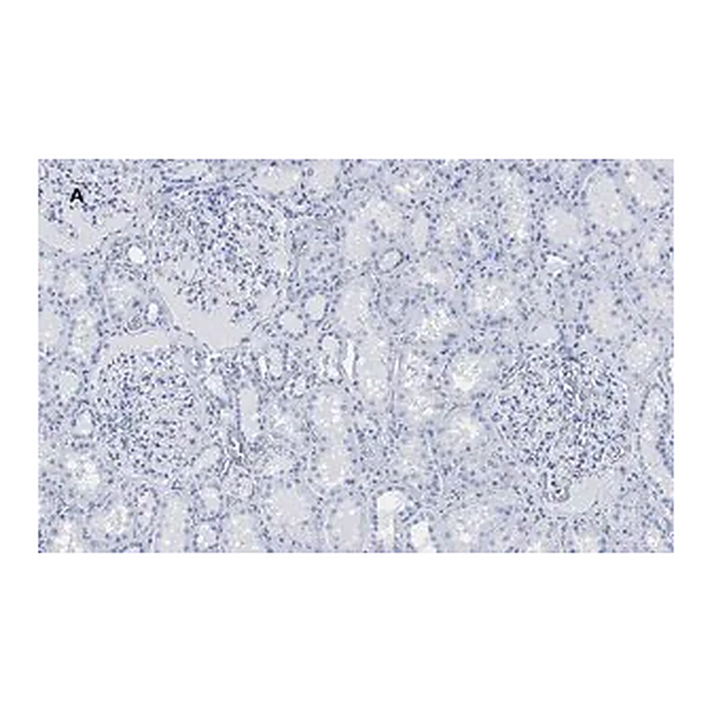 Merck Anti-PLA2R1 Antibody, clone 1D5, ZooMAb Rabbit Monoclonal