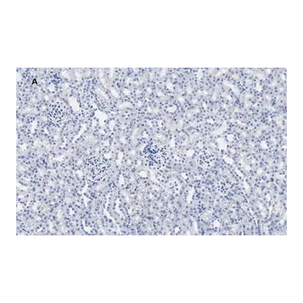 Merck Anti-Calbindin D-28K clone 1A11 Antibody, ZooMAb Rabbit Monoclonal