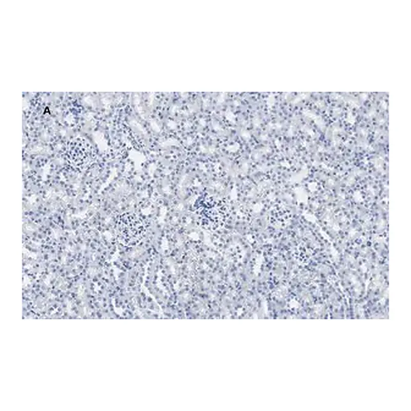 Merck Anti-Calbindin D-28K clone 1A11 Antibody, ZooMAb Rabbit Monoclonal
