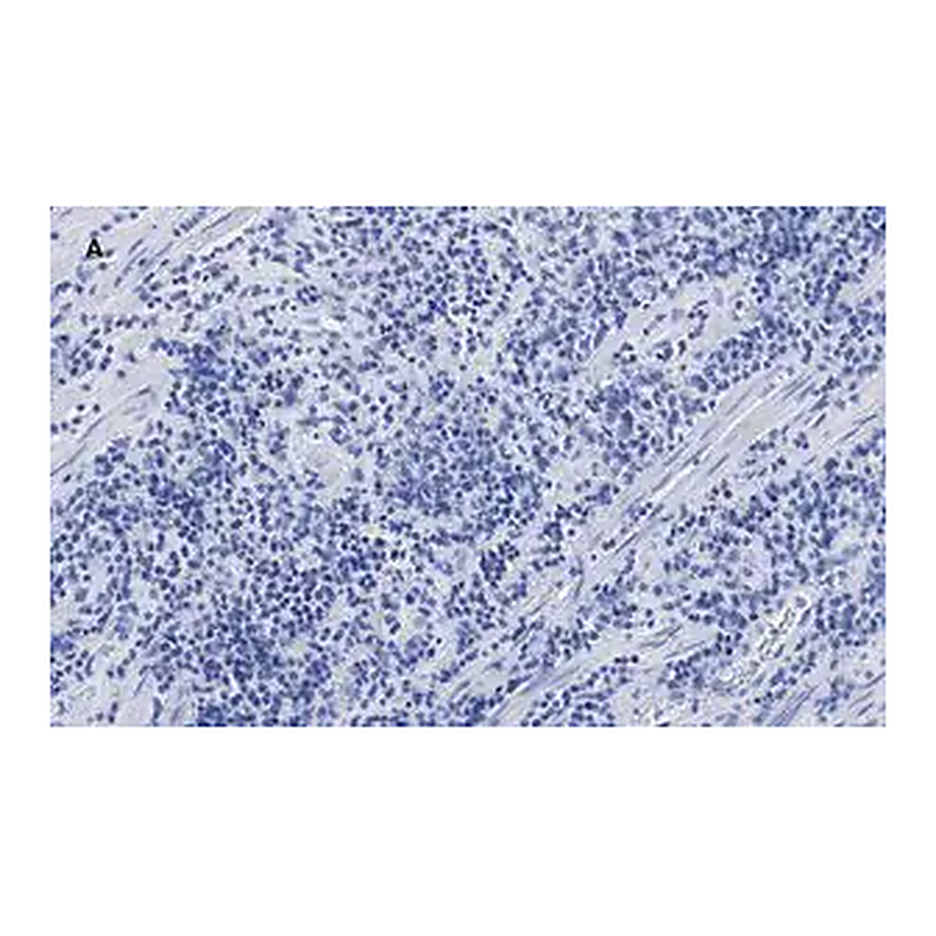 Merck Anti-CTCF antibody, clone 1B18, ZooMAb Rabbit monoclonal
