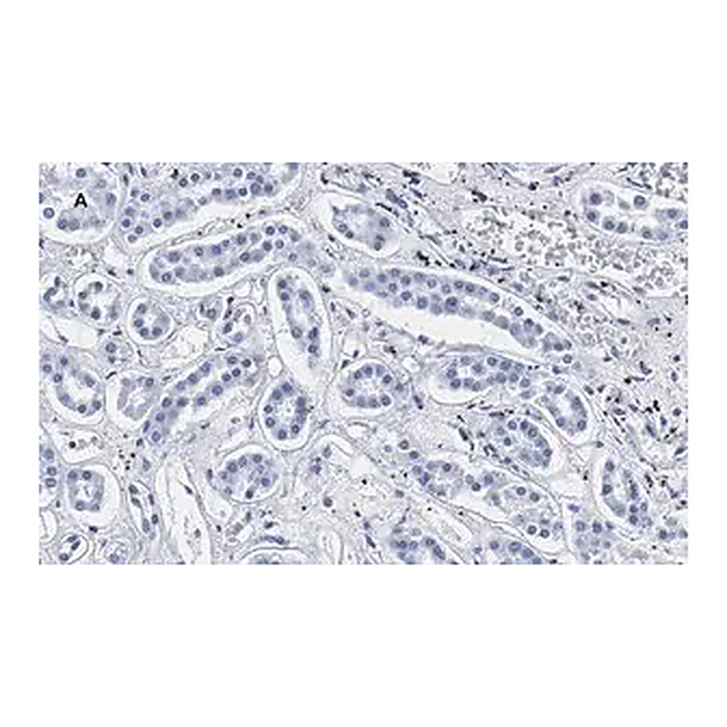 Merck Anti-Smad3 Antibody, clone 1J11, ZooMAb Rabbit Monoclonal