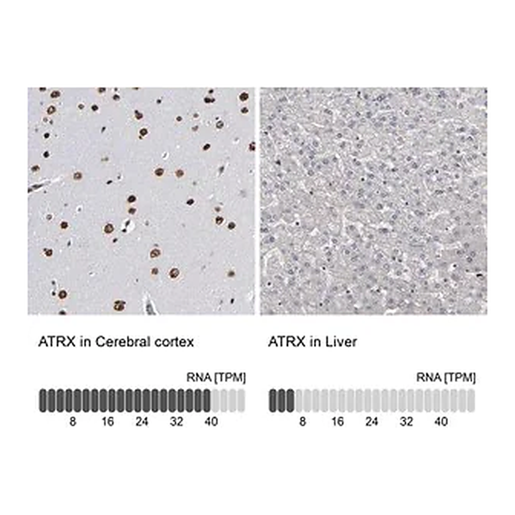 Merck Anti-ATRX antibody produced in rabbit