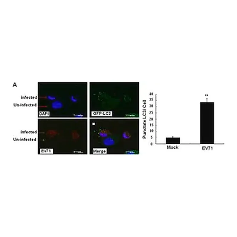 Merck Anti-LC3B antibody produced in rabbit