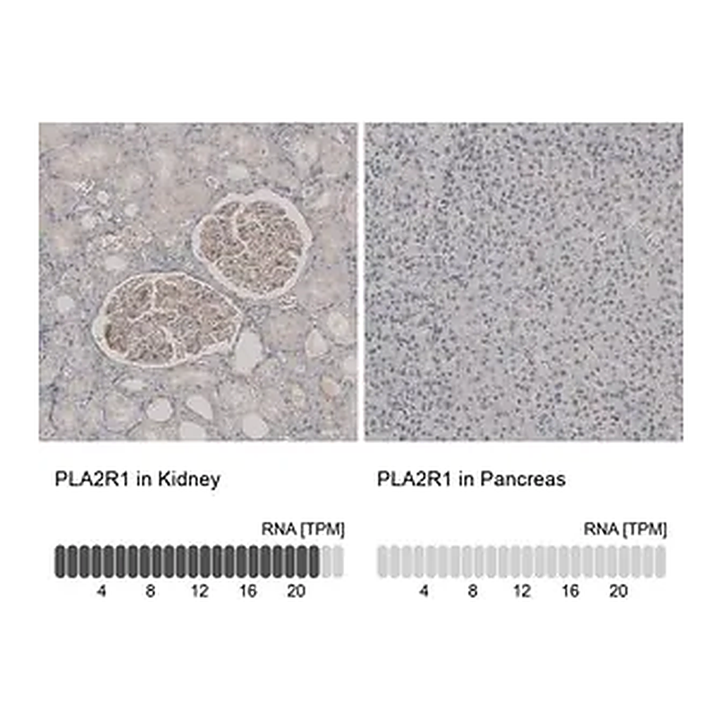 Merck Anti-PLA2R1 antibody produced in rabbit