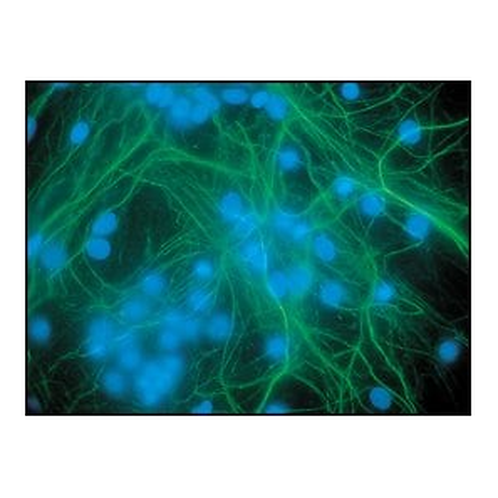 Merck Anti-Neurofilament 200 antibody produced in rabbit
