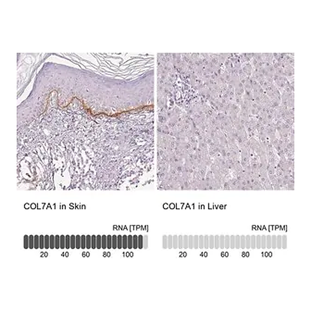 Merck Anti-COL7A1 antibody produced in rabbit