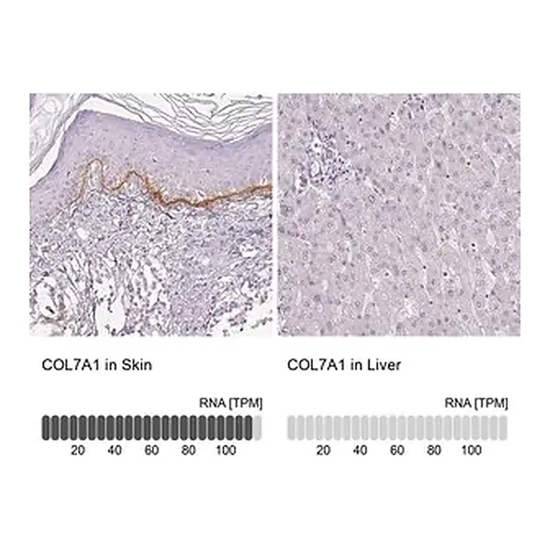 Merck Anti-COL7A1 antibody produced in rabbit