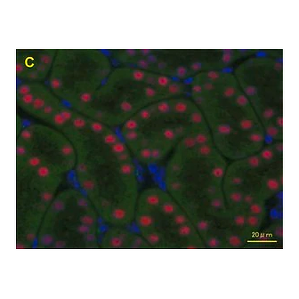 Merck Anti-HNF1B antibody produced in rabbit